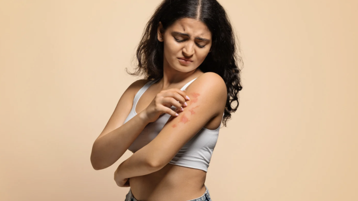 Best Clinic for Psoriasis Treatment Near Chesapeake Beach MD